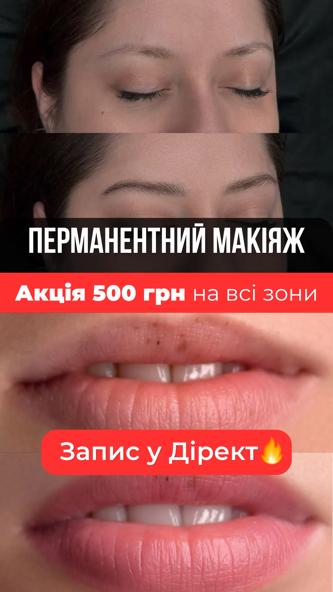 Кейс перманент